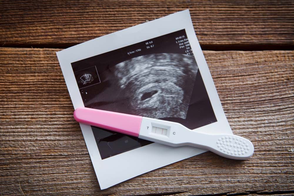 Ultraschall Frauenarzt